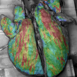 Research Area Image - lung