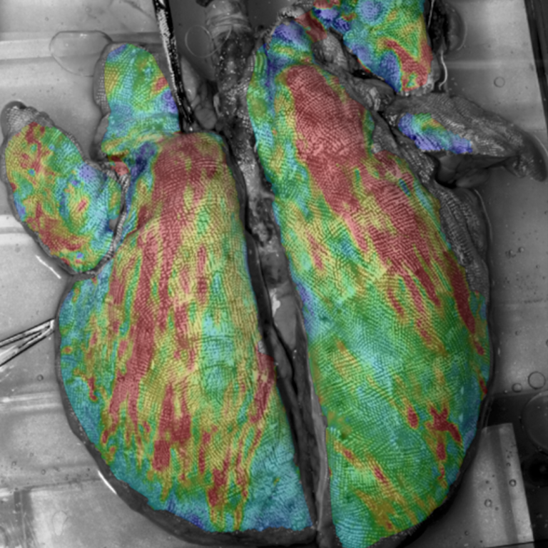 Research Area Image - lung